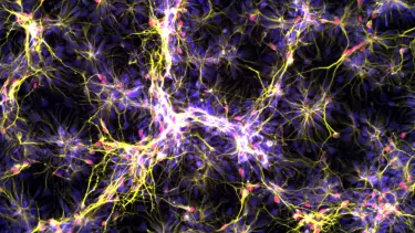 Yellow purple and red cortical cells spread out against a dark background grown by Cortical Labs Melbourne